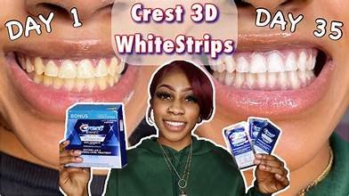 Crest Whitening Strips Before and After: Real Results Explained